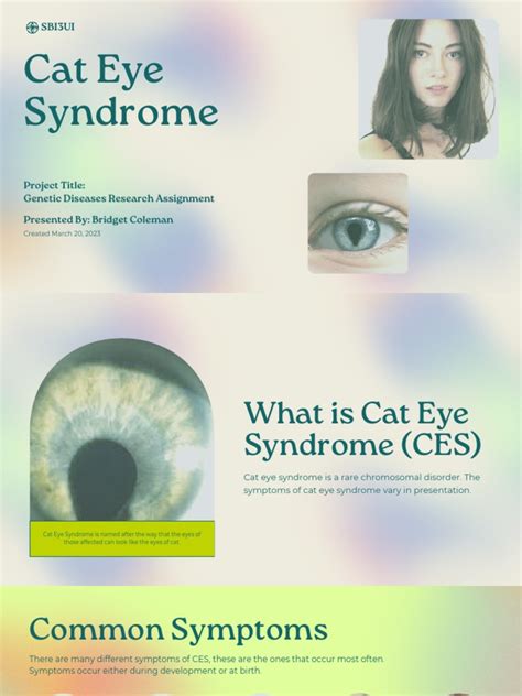 Cat Eye Syndrome Pdf Diseases And Disorders Clinical Medicine