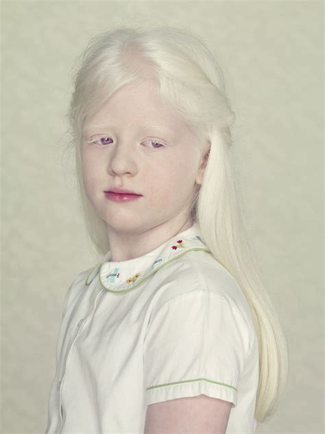 Beautiful Portraits Of Albinos By Gustavo Lacerda Albino Model Albino Girl Portrait