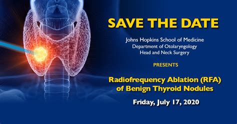 Johns Hopkins Virtual Thyroid Rfa Conference Cmes Provided