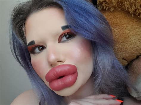 Bulgarian Woman With ‘biggest Lips’ In The World To Inject Lips For 27th Time This Christmas