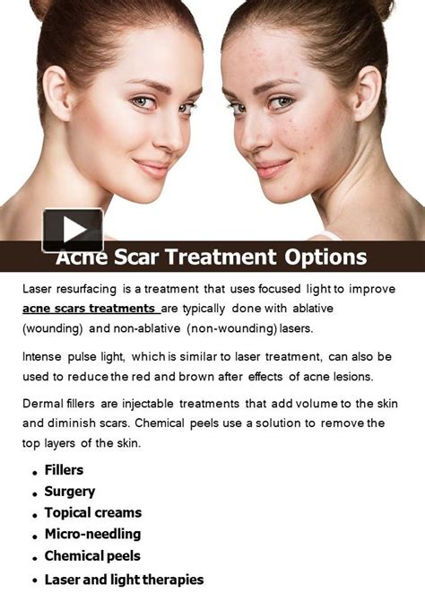 Ppt Acne Scar Treatment Options Powerpoint Presentation Free To