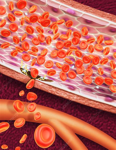 Blood Clotting Stock Image P2600102 Science Photo Library