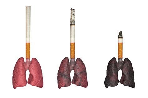 Cigarettes Before And After Lungs
