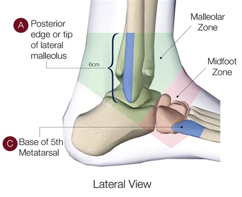 Ankle Pain When Should You Go Get An X Ray — Movement Is Medicine