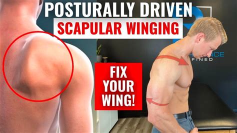 Synthetic Exercises To Fix Scapular Winging The Best B T Ch Xanh