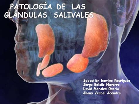 Patología De Las Glándulas Salivales