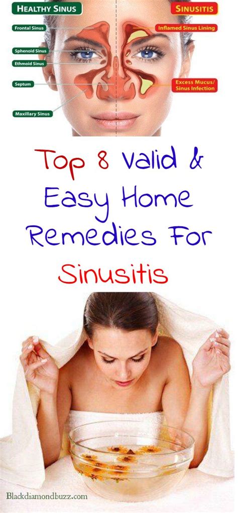 Top 8 Valid And Easy Home Remedies For Sinusitis Natural Headache