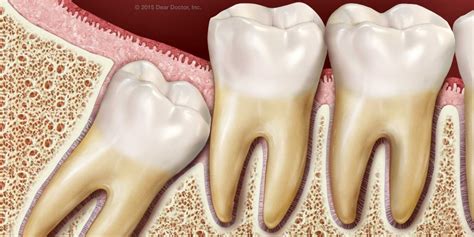 How Evolution Has Affected Wisdom Teeth Dentalplans Blog