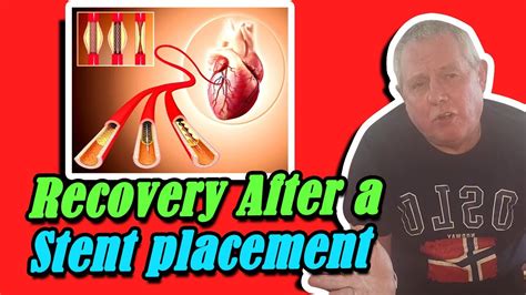 recovery after a stent placement life after a stent youtube