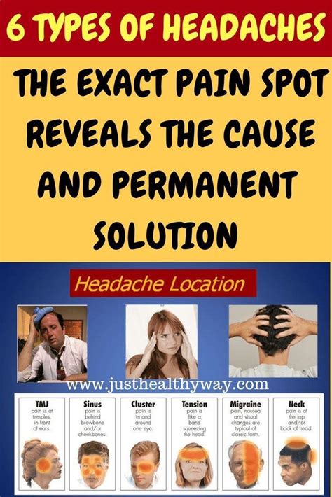 6 Different Types Of Headaches Headache Types Migraines Remedies