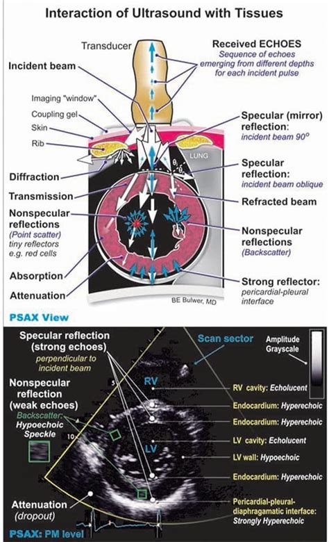 Pin By April May Hensley On Echocardiography Cardiac Sonography