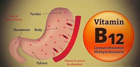 Vitamin B12 And Everything You Need To Know About It My Healthygram