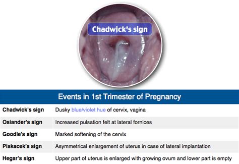 Check the full list of possible causes and conditions now! Rapid Review: Events in 1st Trimester of Pregnancy ...