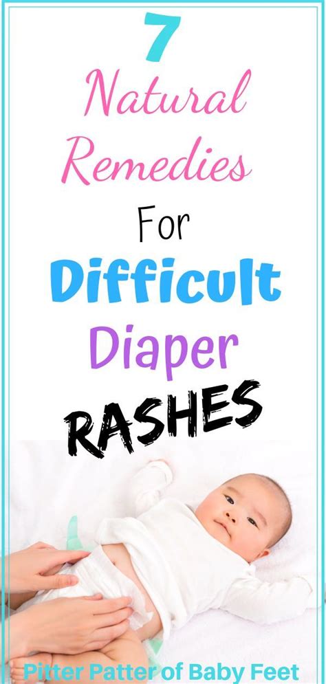 7 Natural Home Remedies To Soothe Your Babys Diaper Rash Baby Diaper