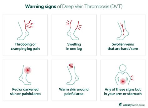 Knowing The Risks Of Dvt Misdiagnosis Gadsby Wicks