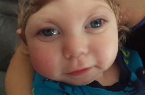 Parents Of Miracle Baby With Microcephaly Speak Out Amid Zika Scare