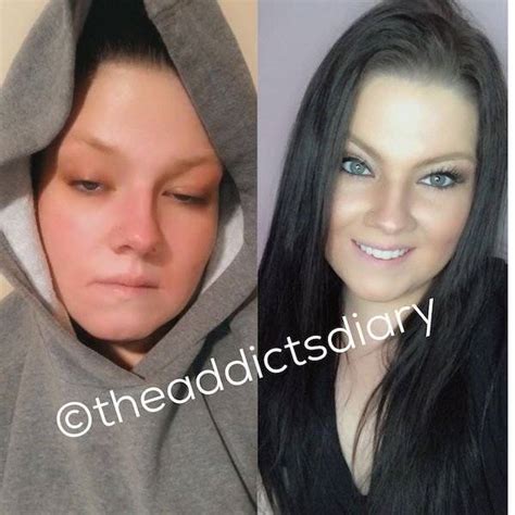 Former Drug Addicts Share Their Inspiring Recovery Stories Pics Gif Izispicy Com