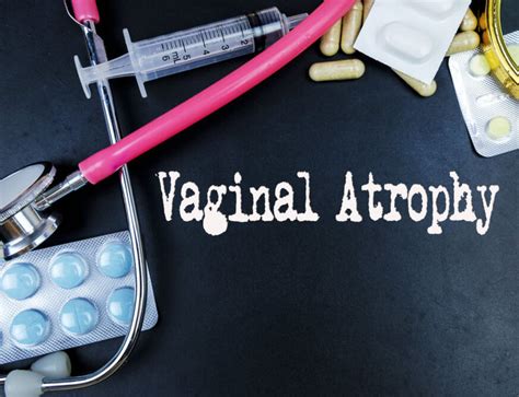Vaginal Gas Causes And Prevention Carreras Medical Center