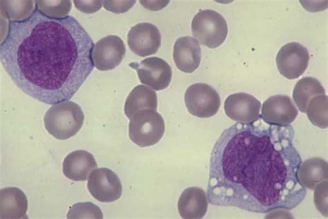Normal Monocytes