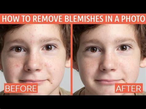 How to remove blemishes from face. How to Remove Skin Blemishes, Spots, and Other ...