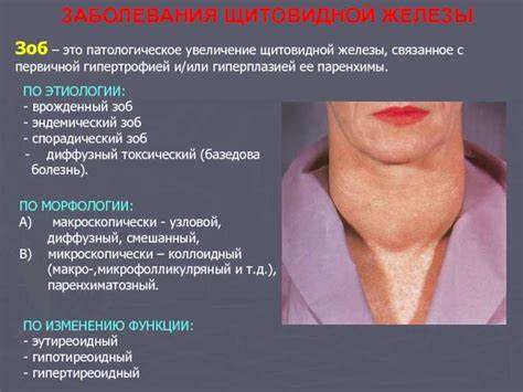 Меню безйодовая диета Зоб щитовидной железы: классификация, симптомы и лечение зоба щитовидки Зоб щитовидной железы: классификация, симптомы и лечение зоба щитовидки Меню безйодовая диета
