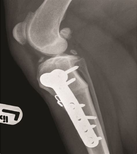 Cruciate Ligament Rupture Dog Knee Surgery Cardiff Cardiff Canine