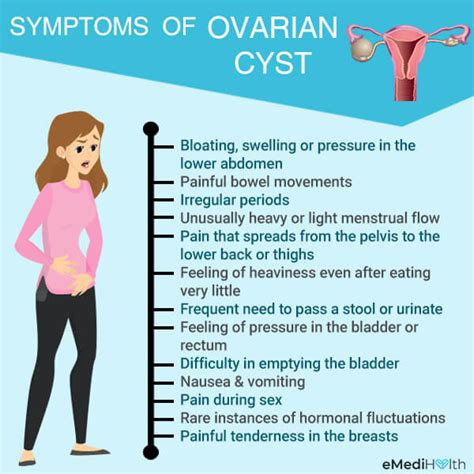 Ovari Cyst Punca Simptom Dan Rawatan Isterisihatcommy