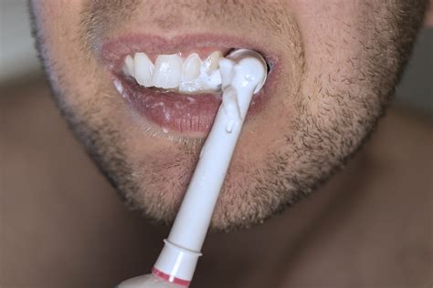 Bitter Taste In The Mouth Causes Symptoms And Treatment For Taste