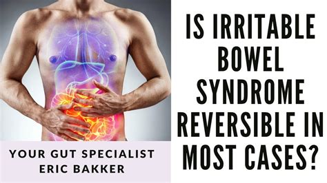 Is Irritable Bowel Syndrome Reversible In Most Cases Youtube