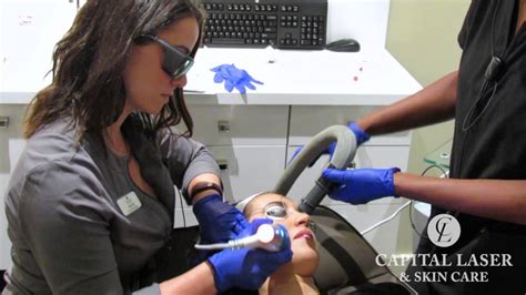 Clear Brilliant Laser Treatment Experience At Capital Laser And Skin