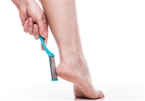 Calluses on your feet can be easily diagnosed via physical examination. AdventureLisa: Removing calluses is good foot care practice