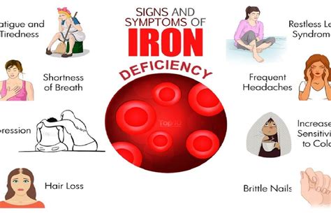 Iron Deficiency Anemia 6 Surprising Facts That Every Woman Needs To