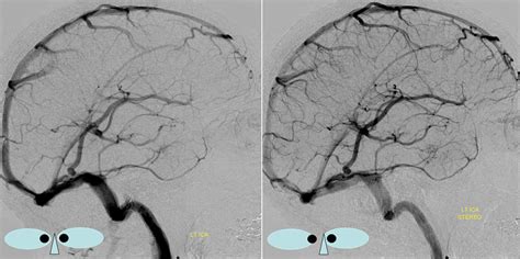 We did not find results for: Superficial Venous System | neuroangio.org