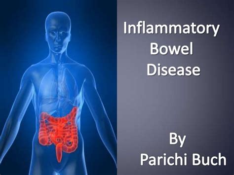 Inflammatory Bowel Disease Ppt Quotes Sites