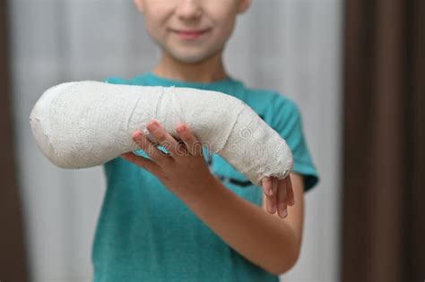 A Boy With A Broken Arm In A Cast Close Up Stock Photo Image Of