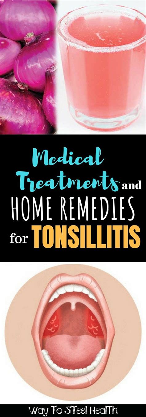 Medical Treatments And Home Remedies For Tonsillitis Tonsilitis