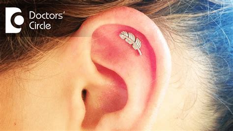 How To Manage An Infected Cartilage Of Helix Post Ear Piercing Dr