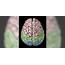 Cerebral Hemorrhage Causes  General Center SteadyHealthcom