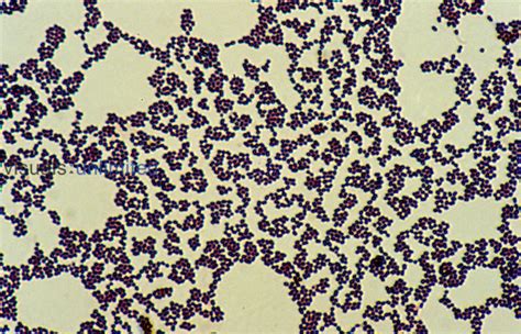 Streptococcus Faecalis Bacteria Visuals Unlimited