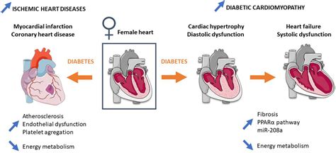 Frontiers Sex Differences Of The Diabetic Heart