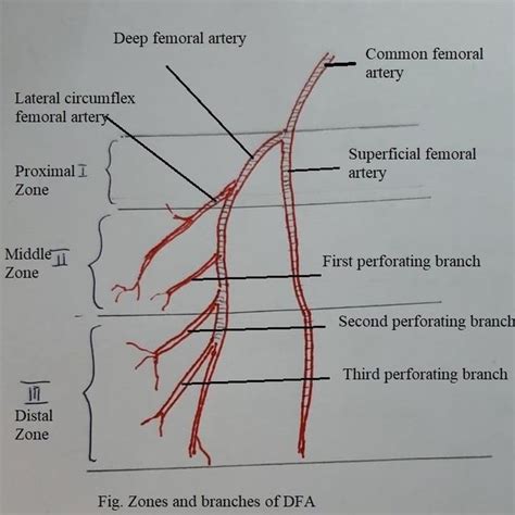 Pdf Technical Report Lateral Approach To The Deep Femoral Artery In