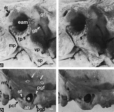 Stereopairs Of Auditory Regions Of Homo Sapiens A Oblique
