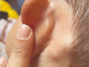 Przypadek erytromelalgii małżowiny usznej u dziecka Ciekawe przypadki