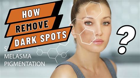 How To Remove Dark Spots From Face Darkspots Face Removedarkspot