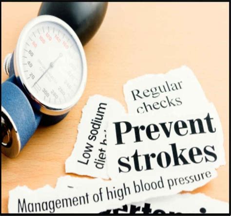 Experts Update Stroke Prevention Guidelines