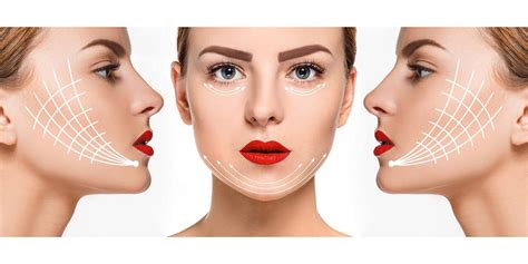 Before After Gallery Toronto Facial Plastic Surgery And Laser Centre