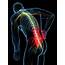 Human Back Pain Photograph By Sebastian Kaulitzki
