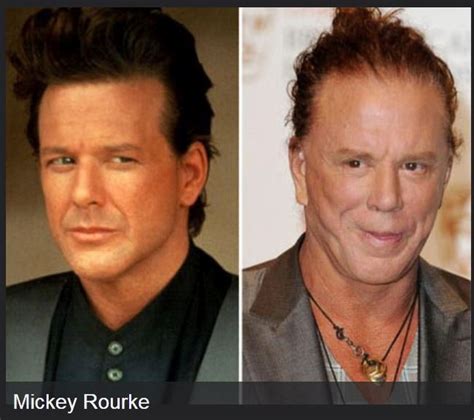 Celebrities Before And After Plastic Surgeries 22 Pics