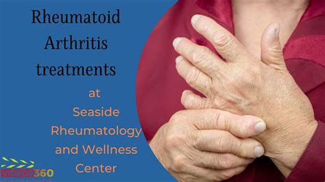 Rheumatoid Arthritis Treatment Encinitas Ca Integrative Therapy