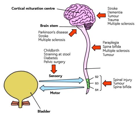 How Neurological Conditions Affect Bladder Function